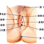 阴道整形,技术、效果与术后护理全解析