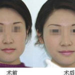 面部整形专家,塑造自然美，揭秘面部整形三大方法