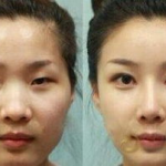 最好的鼻部整形,专业技巧与个性化方案解析